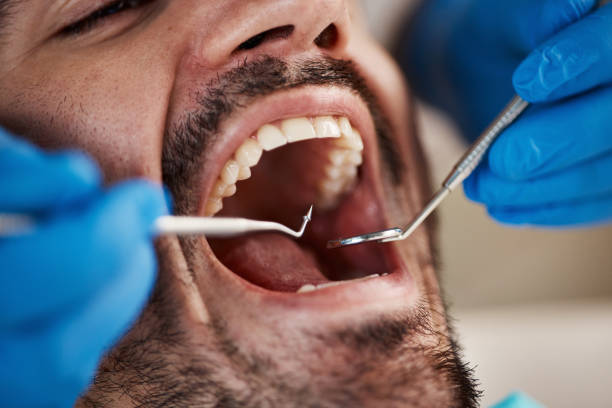 Best Walk-In Emergency Dentist in Edwardsville, PA